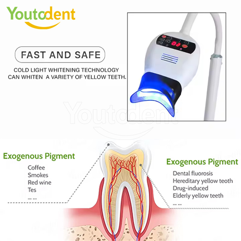 전문 치과용 3색 광 램프 치아 미백기 미백 촉진 장치 - Teeth Whitening (Bleaching) 리뷰 및 가격