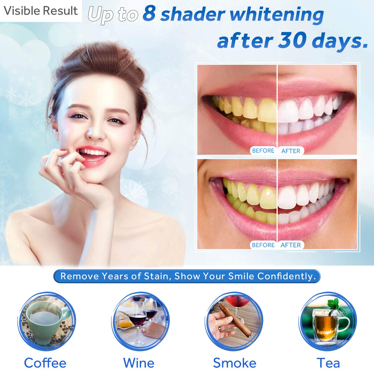 치아 미백 젤 리필 주사기 치아 미백 젤 인비스알라인  - Colgate Whitening Teeth 리뷰 및 가격
