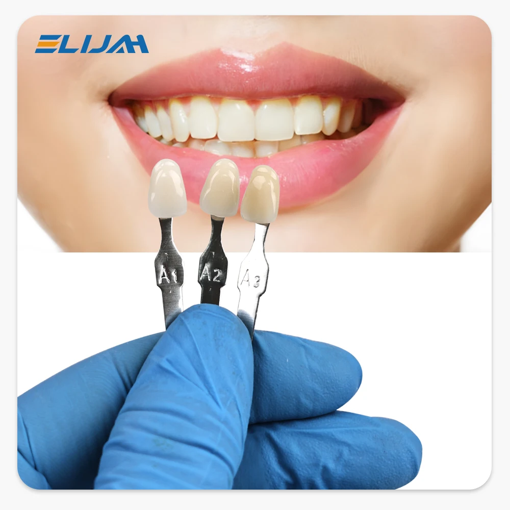 엘리야 마스터 치아 미백 색상표 16색 치아 미백 비교 - Teeth Whitening (Bleaching) 리뷰 및 가격
