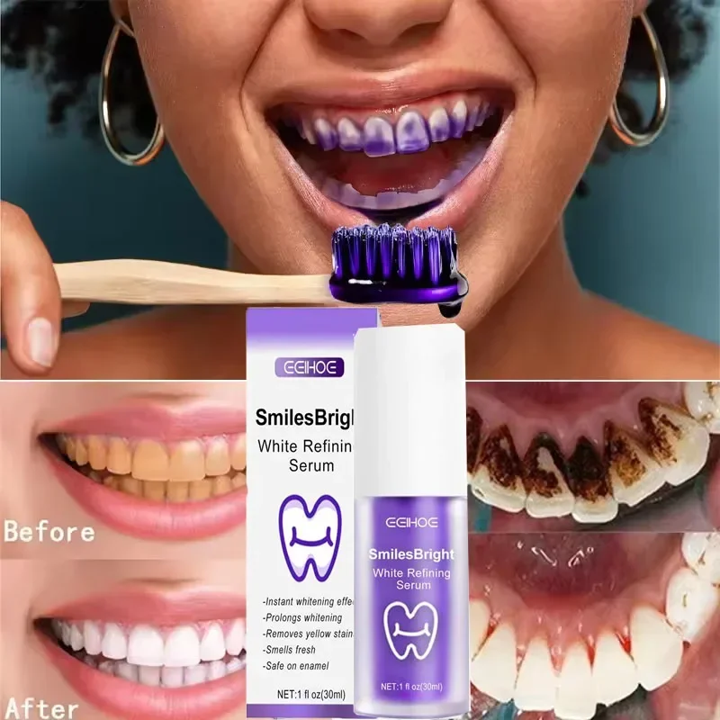 치아 세정 미백 치약 화이트닝 젤 미백제 얼룩 제거 상 - Teeth Whitening In Korea 리뷰 및 가격