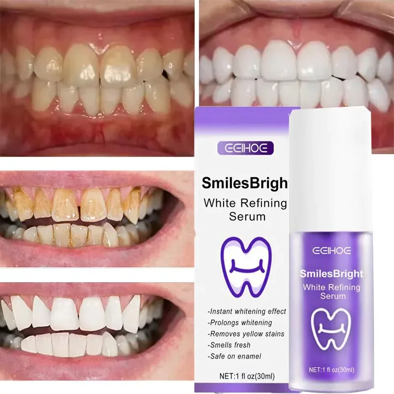치아 세정 미백 치약 화이트닝 젤 미백제 얼룩 제거 상 - Teeth Whitening In Korea 리뷰 및 가격