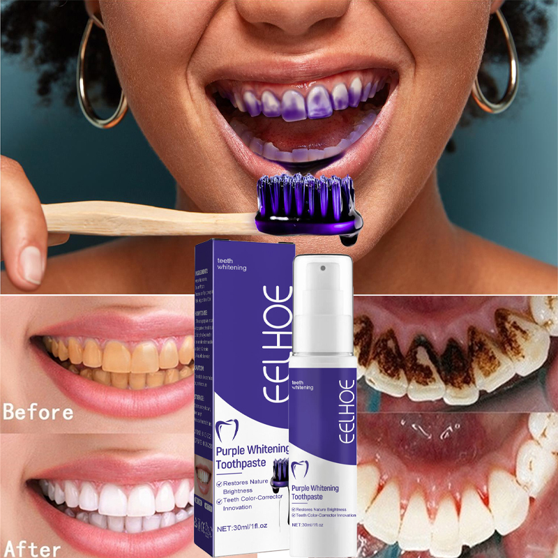 치아 클렌징 미백 치약, 미백 젤 표백제, 얼룩 제거, - Teeth Whitening In Korea 리뷰 및 가격