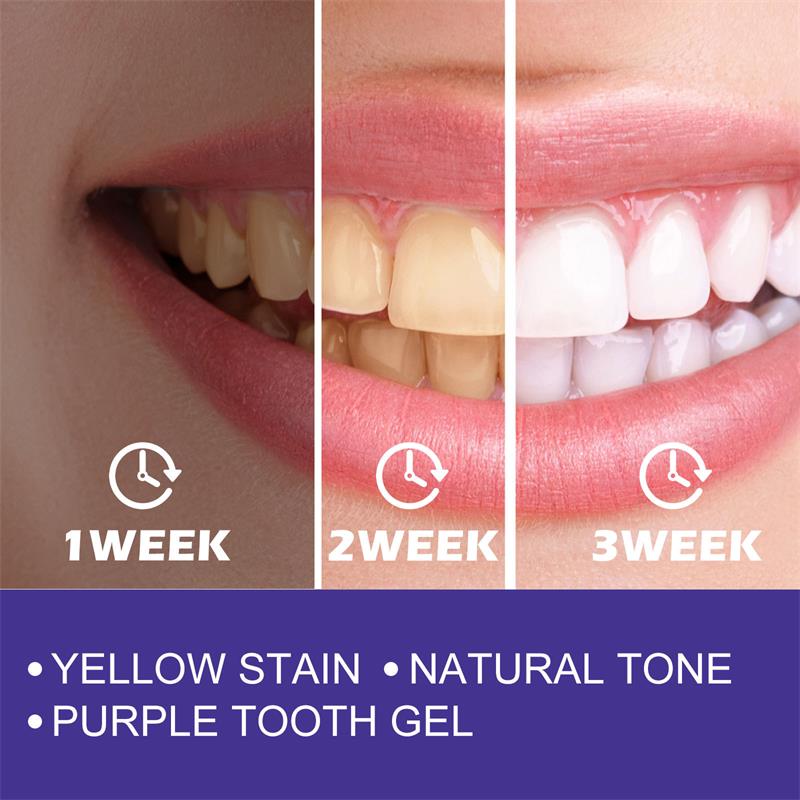 치아 클렌징 미백 치약, 미백 젤 표백제, 얼룩 제거, - Teeth Whitening In Korea 리뷰 및 가격
